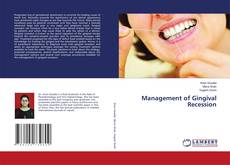 Bookcover of Management of Gingival Recession