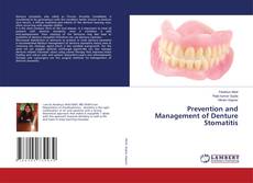 Copertina di Prevention and Management of Denture Stomatitis