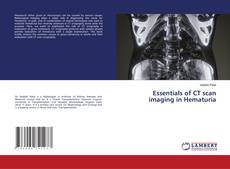 Buchcover von Essentials of CT scan imaging in Hematuria