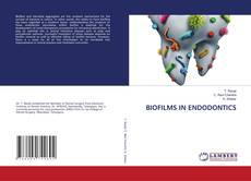 Buchcover von BIOFILMS IN ENDODONTICS