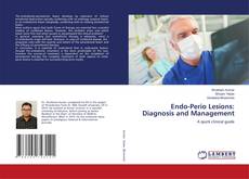 Copertina di Endo-Perio Lesions: Diagnosis and Management