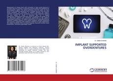 Buchcover von IMPLANT SUPPORTED OVERDENTURES