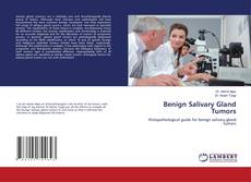 Copertina di Benign Salivary Gland Tumors