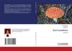 Buchcover von Oral Candidiasis