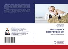 Copertina di ОМФАЛОЦЕЛЕ У НОВОРОЖДЁННЫХ