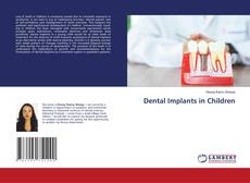 Copertina di Dental Implants in Children