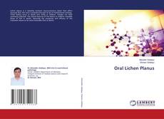 Copertina di Oral Lichen Planus