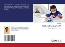 Copertina di Posts in Primary Teeth