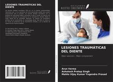 Bookcover of LESIONES TRAUMÁTICAS DEL DIENTE