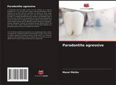 Couverture de Parodontite agressive