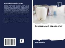 Buchcover von Агрессивный пародонтит