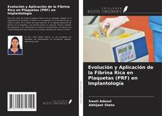 Portada del libro de Evolución y Aplicación de la Fibrina Rica en Plaquetas (PRF) en Implantología