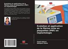 Capa do livro de Évolution et application de la fibrine riche en plaquettes (PRF) en implantologie 