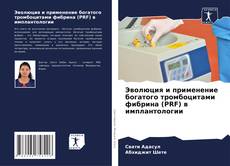 Borítókép a  Эволюция и применение богатого тромбоцитами фибрина (PRF) в имплантологии - hoz