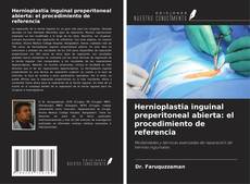 Bookcover of Hernioplastia inguinal preperitoneal abierta: el procedimiento de referencia