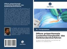 Offene präperitoneale Leistenhernienplastik: das Goldstandardverfahren的封面