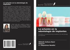 Copertina di La oclusión en la odontología de implantes