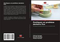 Copertina di Pontiques en prothèse dentaire fixe
