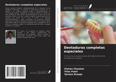 Bookcover of Dentaduras completas especiales