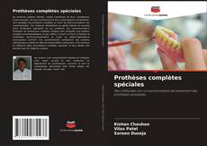 Bookcover of Prothèses complètes spéciales