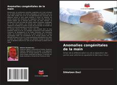 Bookcover of Anomalies congénitales de la main