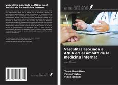 Couverture de Vasculitis asociada a ANCA en el ámbito de la medicina interna: