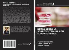 Bookcover of NOTAS SOBRE LA SOBREDENTADURA CON SOPORTE DENTAL