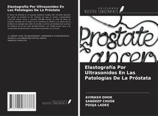 Elastografía Por Ultrasonidos En Las Patologías De La Próstata kitap kapağı