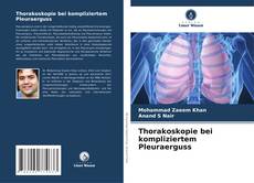 Bookcover of Thorakoskopie bei kompliziertem Pleuraerguss