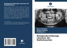 Couverture de Röntgendurchlässige Läsionen der Kieferknochen