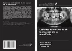 Bookcover of Lesiones radiolúcidas de los huesos de la mandíbula