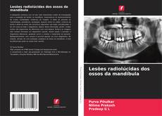 Lesões radiolúcidas dos ossos da mandíbula kitap kapağı