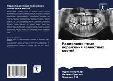 Buchcover von Радиолюцентные поражения челюстных костей