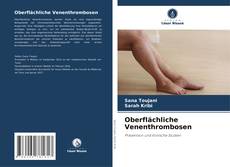 Oberflächliche Venenthrombosen kitap kapağı