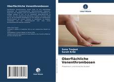 Portada del libro de Oberflächliche Venenthrombosen