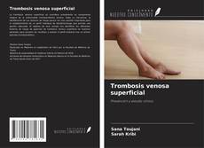 Buchcover von Trombosis venosa superficial