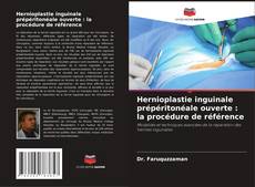 Buchcover von Hernioplastie inguinale prépéritonéale ouverte : la procédure de référence