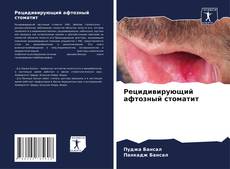 Capa do livro de Рецидивирующий афтозный стоматит 