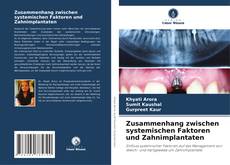 Buchcover von Zusammenhang zwischen systemischen Faktoren und Zahnimplantaten