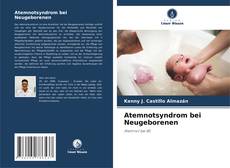 Atemnotsyndrom bei Neugeborenen kitap kapağı
