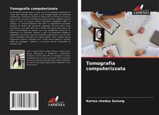 Bookcover of Tomografia computerizzata