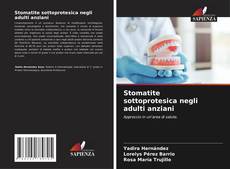 Bookcover of Stomatite sottoprotesica negli adulti anziani