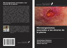 Buchcover von Microorganismos asociados a las úlceras de la pierna