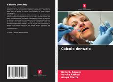 Bookcover of Cálculo dentário