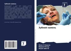 Capa do livro de Зубной камень 
