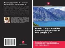 Bookcover of Estudo comparativo das fracturas periprotéticas com pregos e lo
