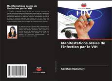 Capa do livro de Manifestations orales de l'infection par le VIH 
