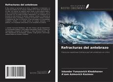Bookcover of Refracturas del antebrazo