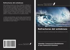 Copertina di Refracturas del antebrazo