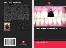 IMPLANTES DENTÁRIOS kitap kapağı